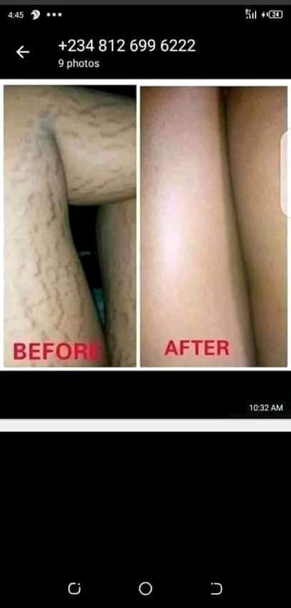 FB_IMG_15835835348021842