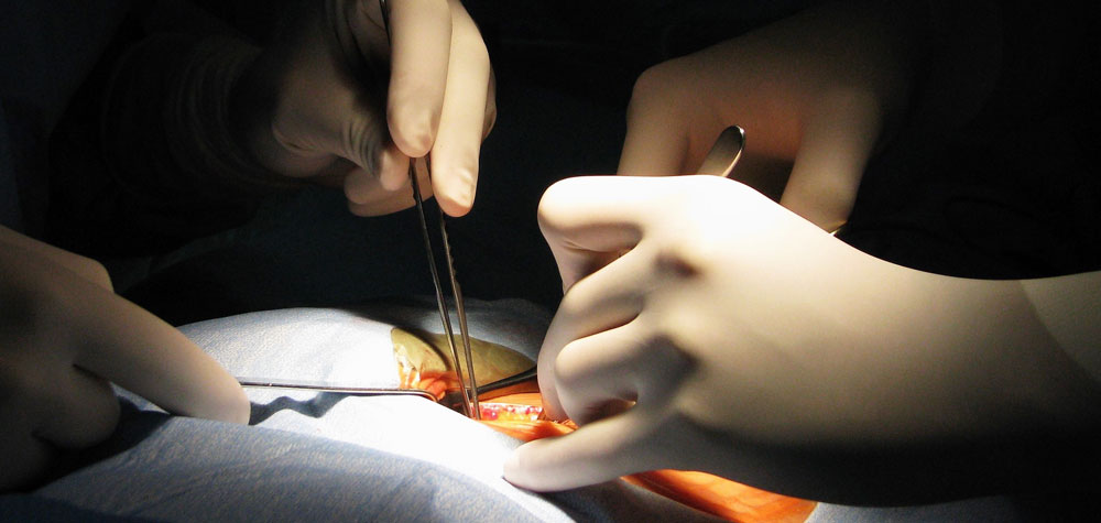 illustrationTransplantation_1